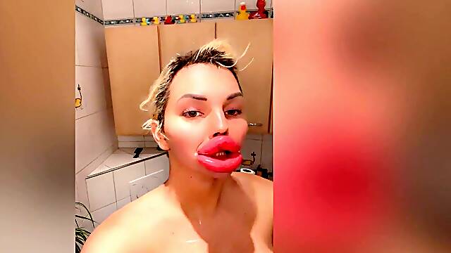 Most Extraordinary Engorged Silly Faux Botox Lips in Public - Vienna Xtreme